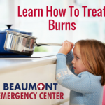 Learn How To Treat Burns