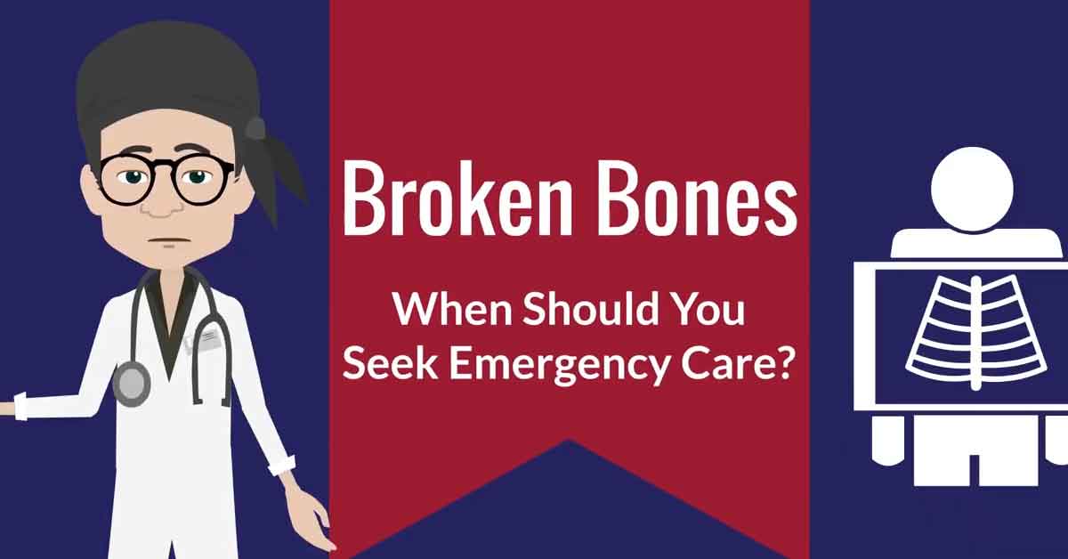 Broken Bone Treatment