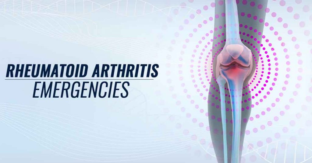 Rheumatoid Arthritis Symptoms and Treatment