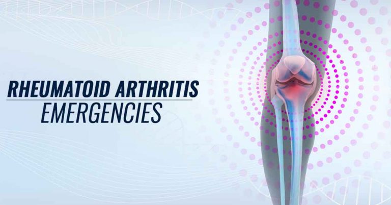 Arthritis Symptoms Worthy Of An ER Visit - Beaumont Emergency Hospital