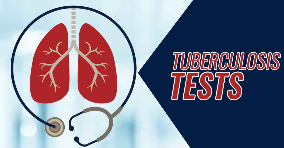 Tuberculosis Testing