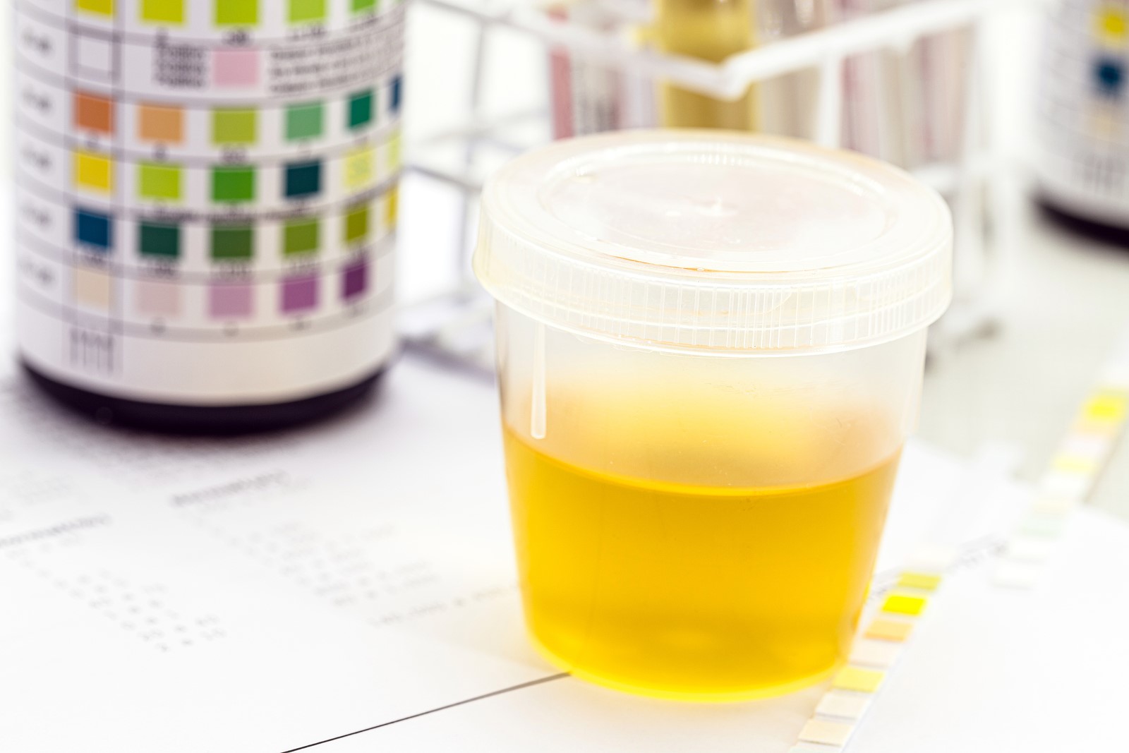 What Does Bright Red Blood In Your Urine Mean