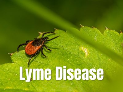 Lyme Disease Symptoms, Causes, Questions Answered