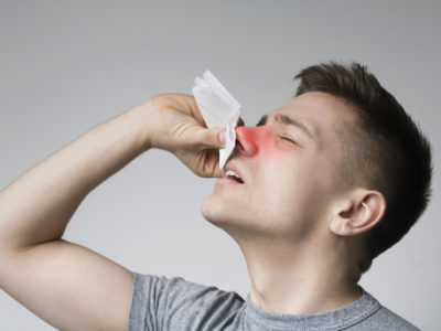 What to Do When You Have a Nosebleed