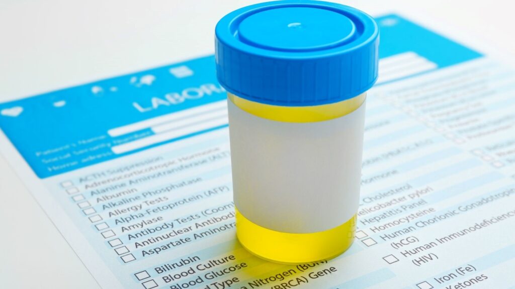 The Significance of Urinalysis in Emergency Medicine