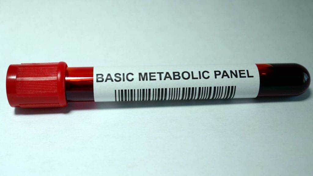 Basic Metabolic Panel