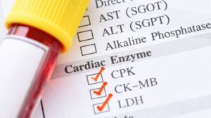 Cardiac Enzyme Testing: The Role in Heart Health